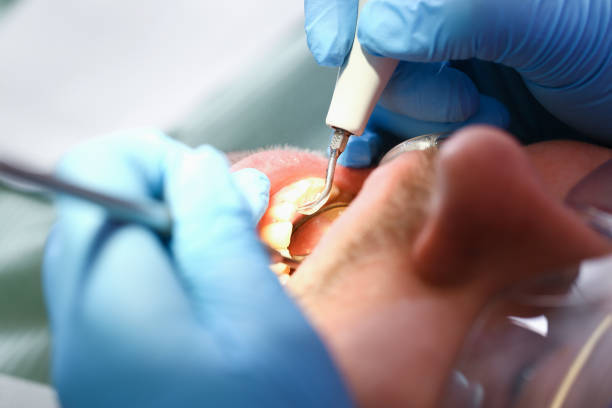 Best Emergency Orthodontic Repairs in Burr Ridge, IL