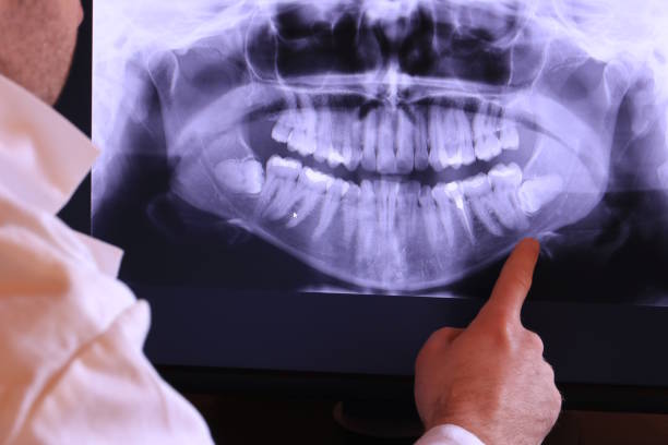 Best Pediatric Emergency Dentist in Burr Ridge, IL