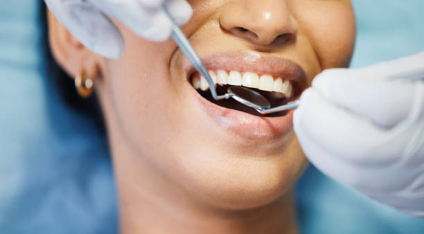 Best Emergency Dental Care for Trauma or Injury in Burr Ridge, IL